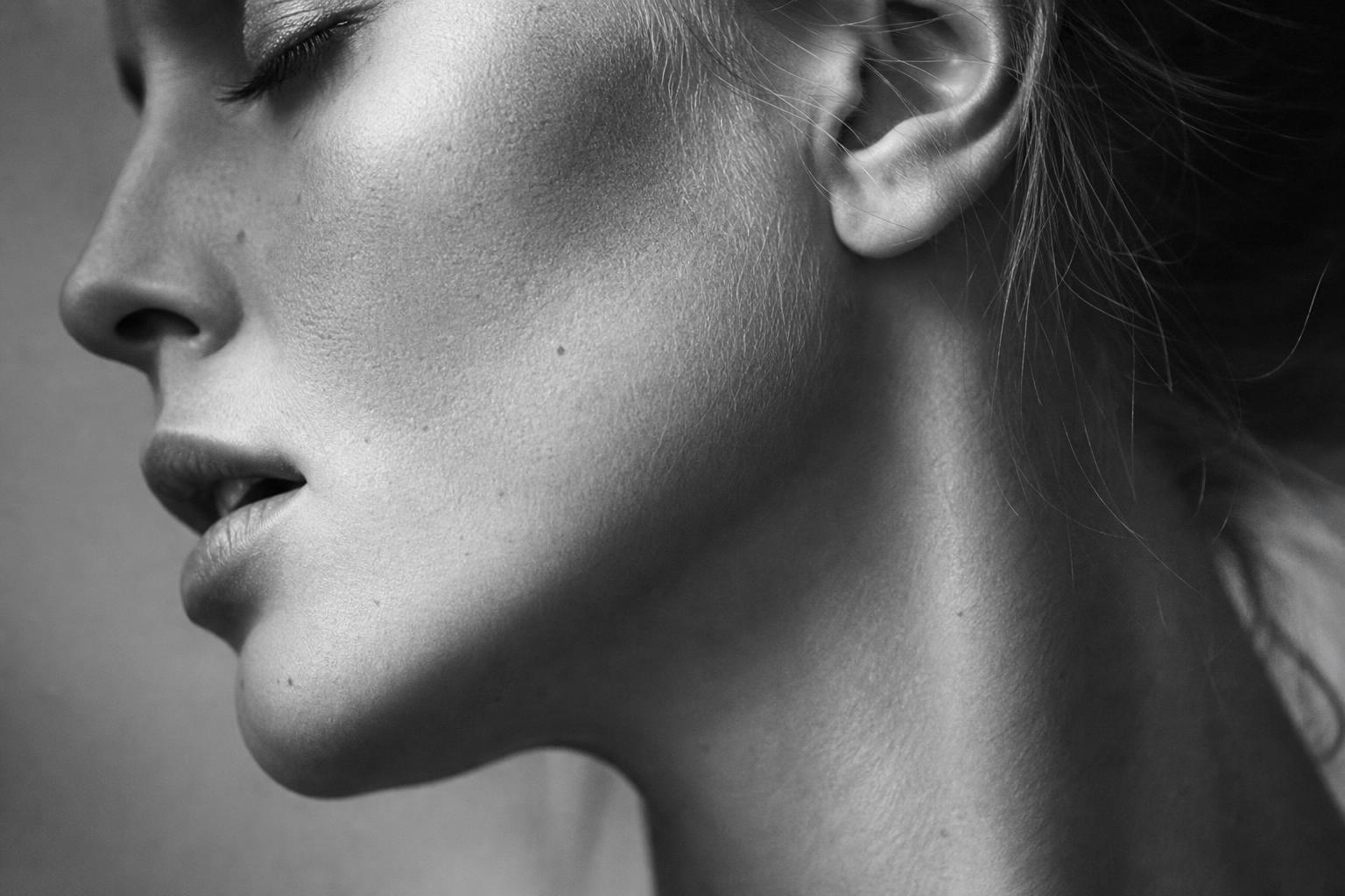 Dermal Fillers