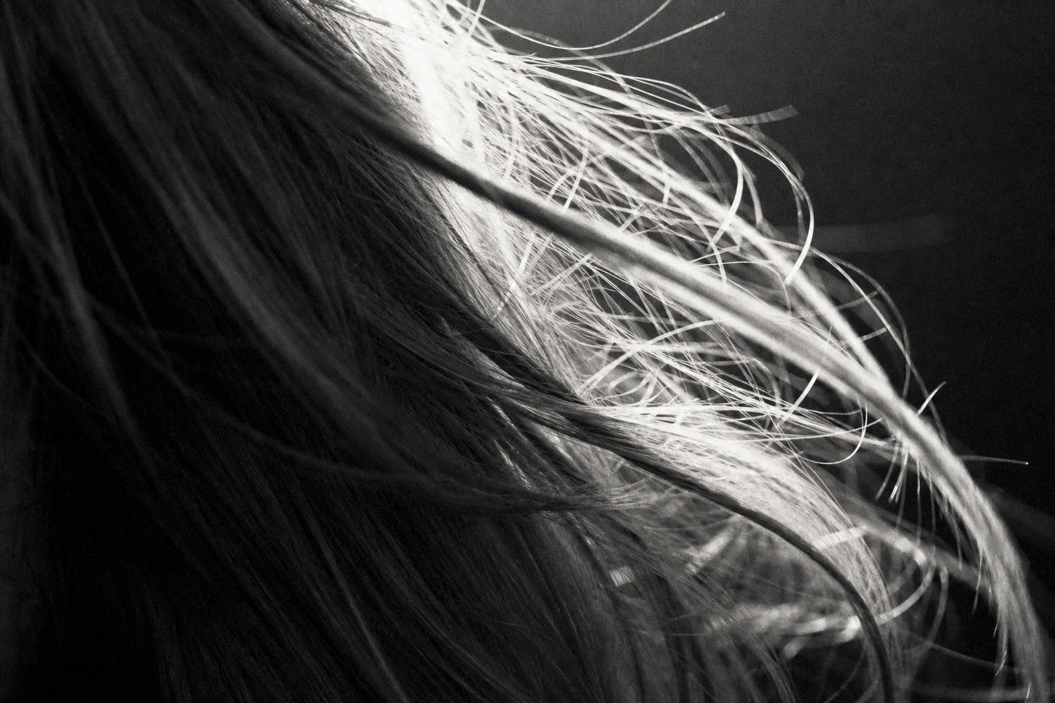 Hair Restoration